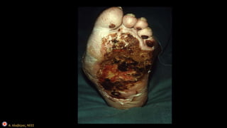 Α. Αλαβέρας, ΝΕΕΣ 
 