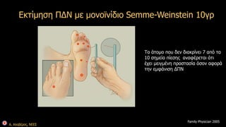 Εκτίμηση ΠΔΝ με μονοϊνίδιο Semme-Weinstein 10γρ 
Α. Αλαβέρας, ΝΕΕΣ 
Το άτομο που δεν διακρίνει 7 από τα 
10 σημεία πίεσης αναφέρεται ότι 
έχει μειγμένη προστασία όσον αφορά 
την εμφάνιση ΔΠΝ 
Family Physician 2005 
 