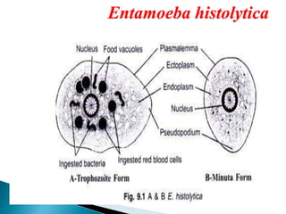 Entamoeba histolytica
 