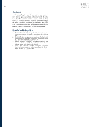 234

Conclusão
A estratificação natural com resinas compostas é
uma técnica que possibilita o restabelecimento da estrutura dental natural em forma, função e estética. Dessa
forma, o cirurgião dentista necessita entender os tipos
de resina composta existentes no mercado, bem como
suas características de cor e espessura de camadas, para
que não haja erros durante a técnica restauradora.

Referências bibliográficas
1.	
2.	
3.	
4.	

Dietschi D. Free-hand bonding in the esthetic treatment of anterior teeth: creating the illusion. J Esthet Dent. 1997;9(4):15664.
Dietschi D. Optimizing smile composition and esthetics with
resin composites and other conservative esthetic procedures.
Eur J Esthet Dent. 2008 Spring;3(1):14-29.
Reis A., Higashi C., Loguercio A.D. Re-anatomization of anterior eroded teeth by stratification with direct composite resin.
J Esthet Restor Dent. 2009;21(5):304-16.
Verde F.A.V., Sakamoto Junior A.S., Gomes J.C. Naturalidade
com resinas compostas em restaurações Classe IV. Clínica –
Int J Clin Dent 2011;7(3):340-347.

 