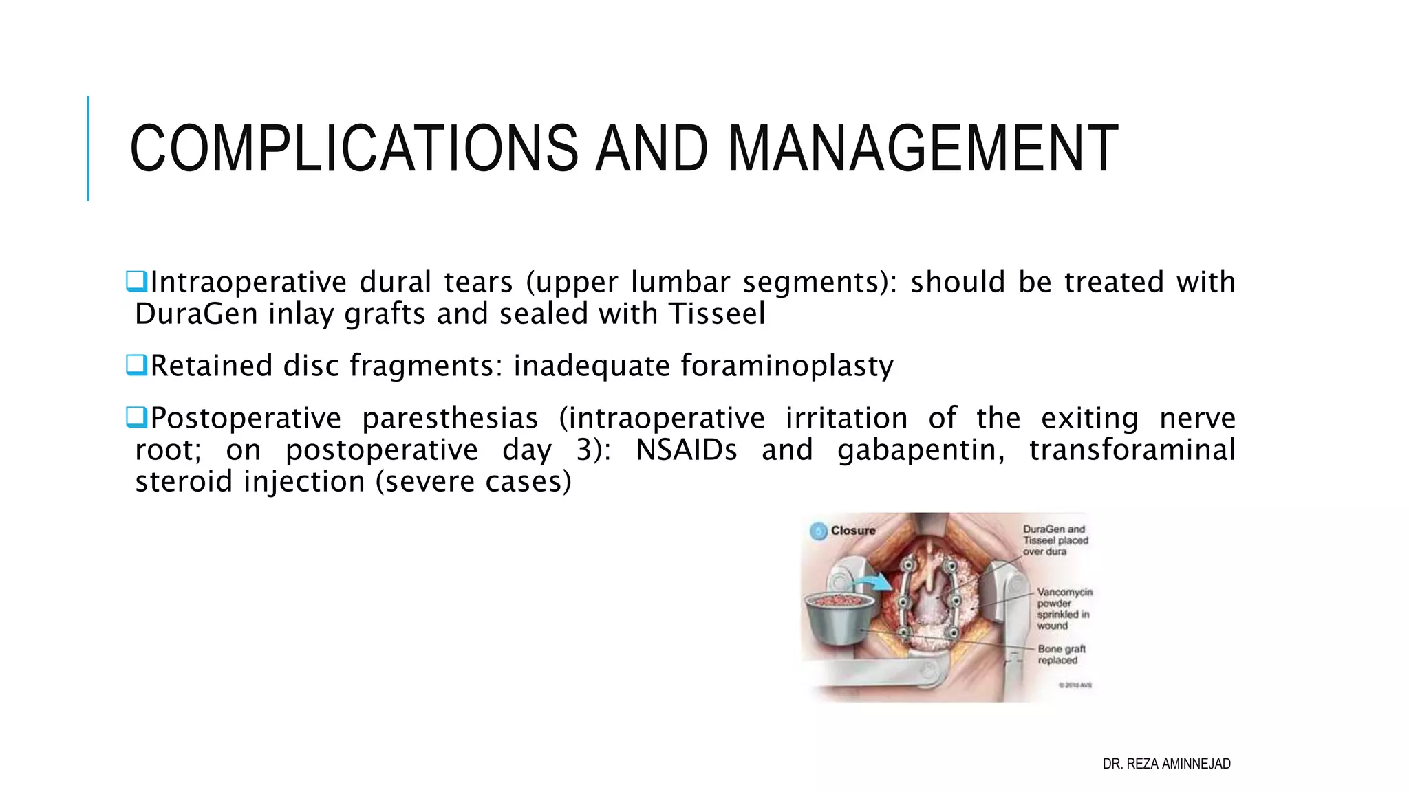 Full Endoscopic Lumbar Discectomy PPT