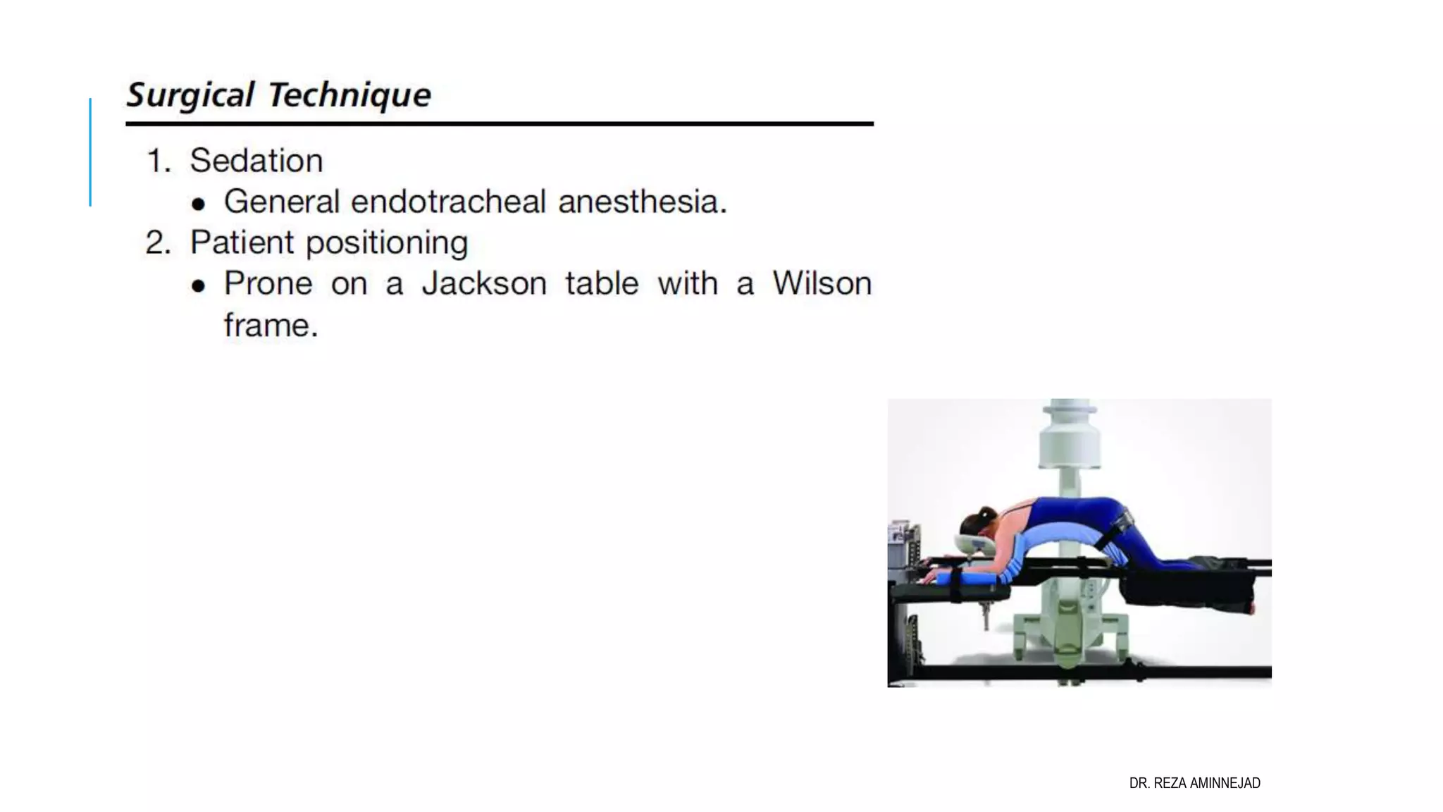 Full Endoscopic Lumbar Discectomy PPT