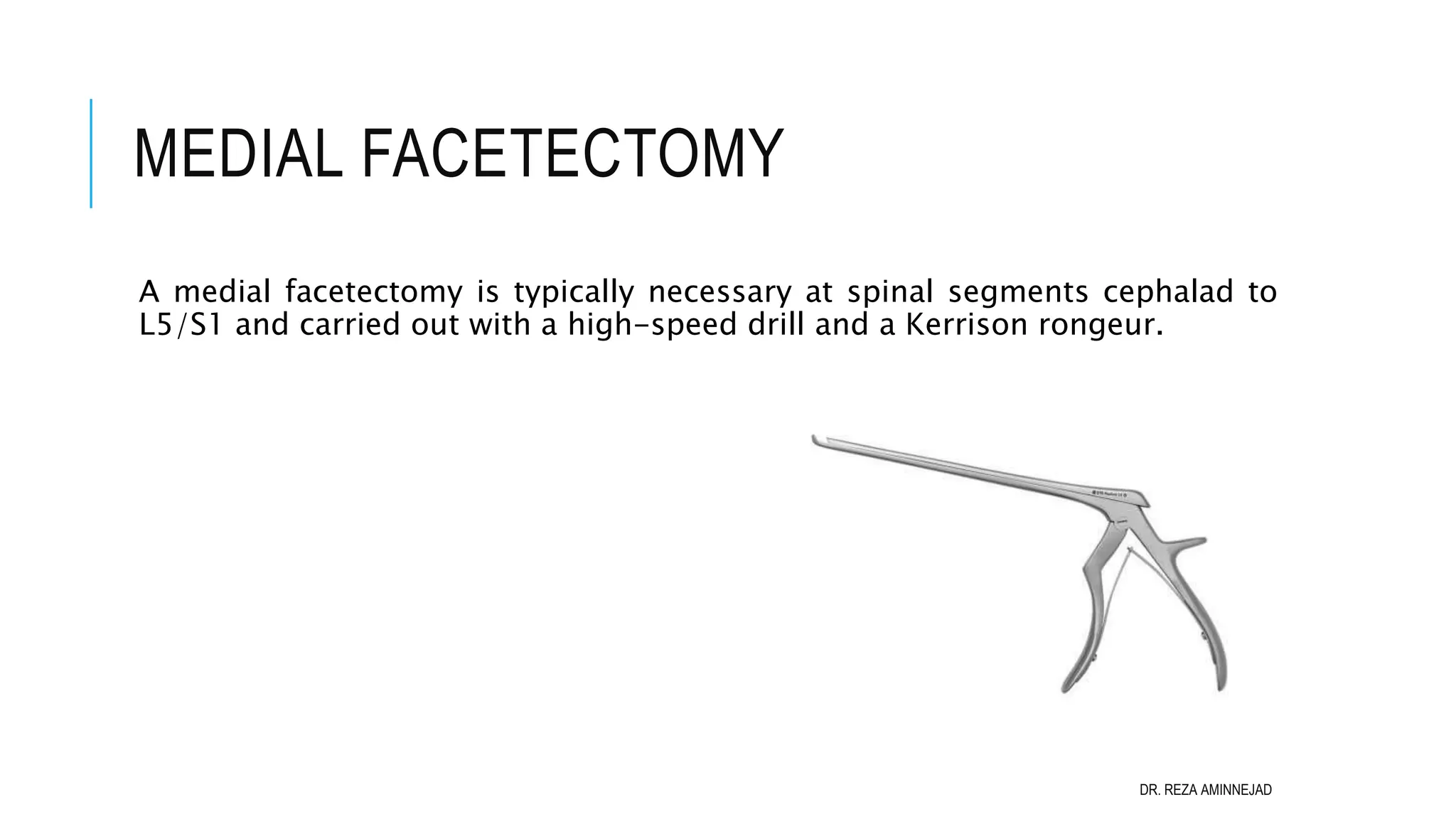 Full Endoscopic Lumbar Discectomy PPT