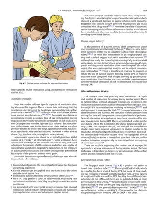 C.D. Deakin et al. / Resuscitation 81 (2010) 1305–1352                                        1319


                                                                                          A manikin study of simulated cardiac arrest and a study involv-
                                                                                      ing ﬁre-ﬁghters ventilating the lungs of anaesthetised patients both
                                                                                      showed a signiﬁcant decrease in gastric inﬂation with manually-
                                                                                      triggered ﬂow-limited oxygen-powered resuscitators and mask
                                                                                      compared with a bag-mask.345,346 However, the effect of automatic
                                                                                      resuscitators on gastric inﬂation in humans in cardiac arrest has not
                                                                                      been studied, and there are no data demonstrating clear beneﬁt
                                                                                      over bag-valve-mask devices.


                                                                                      Passive oxygen delivery

                                                                                         In the presence of a patent airway, chest compressions alone
                                                                                      may result in some ventilation of the lungs.347 Oxygen can be deliv-
                                                                                      ered passively, either via an adapted tracheal tube (Boussignac
                                                                                      tube),348,349 or with the combination of an oropharyngeal air-
                                                                                      way and standard oxygen mask with non-rebreather reservoir.350
                                                                                      Although one study has shown higher neurologically intact survival
                                                                                      with passive oxygen delivery (oral airway and oxygen mask) com-
                                                                                      pared with bag-mask ventilation after out-of-hospital VF cardiac
                                                                                      arrest, this was a retrospective analysis and is subject to numer-
                                                                                      ous confounders.350 There is insufﬁcient evidence to support or
                                                                                      refute the use of passive oxygen delivery during CPR to improve
                                                                                      outcome when compared with oxygen delivery by positive pres-
                                                                                      sure ventilation. Until further data are available, passive oxygen
                                                                                      delivery without ventilation is not recommended for routine use
         Fig. 4.7. The two-person technique for bag-mask ventilation.
                                                                                      during CPR.

interrupted to enable ventilation, using a compression-ventilation
                                                                                      Alternative airway devices
ratio of 30:2.
                                                                                          The tracheal tube has generally been considered the opti-
Automatic ventilators                                                                 mal method of managing the airway during cardiac arrest. There
                                                                                      is evidence that, without adequate training and experience, the
    Very few studies address speciﬁc aspects of ventilation dur-                      incidence of complications, such as unrecognised oesophageal intu-
ing advanced life support. There is some data indicating that the                     bation (6–17% in several studies involving paramedics)351–354 and
ventilation rates delivered by healthcare personnel during cardiac                    dislodgement, is unacceptably high.355 Prolonged attempts at tra-
arrest are excessive,242,340,341 although other studies have shown                    cheal intubation are harmful; the cessation of chest compressions
more normal ventilation rates.245,342,343 Automatic ventilators or                    during this time will compromise coronary and cerebral perfusion.
resuscitators provide a constant ﬂow of gas to the patient during                     Several alternative airway devices have been considered for air-
inspiration; the volume delivered is dependent on the inspiratory                     way management during CPR. There are published studies on the
time (a longer time provides a greater tidal volume). Because pres-                   use during CPR of the Combitube, the classic laryngeal mask air-
sure in the airway rises during inspiration, these devices are often                  way (cLMA), the laryngeal tube (LT) and the I-gel, but none of these
pressure limited to protect the lungs against barotrauma. An auto-                    studies have been powered adequately to enable survival to be
matic ventilator can be used with either a facemask or other airway                   studied as a primary endpoint; instead, most researchers have stud-
device (e.g., tracheal tube, supraglottic airway device).                             ied insertion and ventilation success rates. The supraglottic airway
    An automatic resuscitator should be set initially to deliver a tidal              devices (SADs) are easier to insert than a tracheal tube and, unlike
volume of 6–7 ml kg−1 at 10 breaths min−1 . Some ventilators have                     tracheal intubation, can generally be inserted without interrupting
coordinated markings on the controls to facilitate easy and rapid                     chest compressions.356
adjustment for patients of different sizes, and others are capable of                     There are no data supporting the routine use of any speciﬁc
sophisticated variation in respiratory parameters. In the presence                    approach to airway management during cardiac arrest. The best
of a spontaneous circulation, the correct setting will be determined                  technique is dependent on the precise circumstances of the cardiac
by analysis of the patient’s arterial blood gases.                                    arrest and the competence of the rescuer.
    Automatic resuscitators provide many advantages over alterna-
tive methods of ventilation.
                                                                                      Laryngeal mask airway (LMA)

• In unintubated patients, the rescuer has both hands free for mask                       The laryngeal mask airway (Fig. 4.8) is quicker and easier to
  and airway alignment.                                                               insert than a tracheal tube.357–364 The original LMA (cLMA), which
• Cricoid pressure can be applied with one hand while the other                       is reusable, has been studied during CPR, but none of these stud-
  seals the mask on the face.                                                         ies has compared it directly with the tracheal tube. A wide variety
• In intubated patients they free the rescuer for other tasks.344                     of single-use LMAs are used for CPR, but they have different char-
• Once set, they provide a constant tidal volume, respiratory rate                    acteristics to the cLMA and there are no published data on their
  and minute ventilation; thus, they may help to avoid excessive                      performance in this setting.365 Reported rates of successful venti-
  ventilation.                                                                        lation during CPR with the LMA are very high for in-hospital studies
• Are associated with lower peak airway pressures than manual                         (86–100%)366–369 but generally less impressive (71–90%)370–372 for
  ventilation, which reduces intrathoracic pressure and facilitates                   out-of-hospital cardiac arrest (OHCA). The reason for the relatively
  improved venous return and subsequent cardiac output.                               disappointing results from the LMA in OHCA is not clear.
 