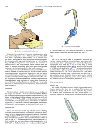 1320                                                       C.D. Deakin et al. / Resuscitation 81 (2010) 1305–1352




                                                                                                                Fig. 4.9. Laryngeal tube. © 2010 ERC.



                 Fig. 4.8. Insertion of a laryngeal mask airway.                         In a manikin CPR study, use of the LT-D reduced the no-ﬂow time
                                                                                         signiﬁcantly in comparison with use of a tracheal tube.386
    When used by inexperienced personnel, ventilation of the lungs
of anaesthetised patients is more efﬁcient and easier with an LMA                        I-gel
than with a bag-mask.330 When an LMA can be inserted with-
out delay it is preferable to avoid bag-mask ventilation altogether.                        The cuff of the I-gel is made of thermoplastic elastomer gel
In comparison with bag-mask ventilation, use of a self-inﬂating                          (styrene ethylene butadene styrene) and does not require inﬂa-
bag and LMA during cardiac arrest reduces the incidence of                               tion; the stem of the I-gel incorporates a bite block and a narrow
regurgitation.333 One study showed similar arterial blood gas                            oesophageal drain tube (Fig. 4.10). It is very easy to insert,
values in patients successfully resuscitated after out-of-hospital                       requiring only minimal training and a laryngeal seal pressure
cardiac arrest when either an LMA or bag mask was used.373                               of 20–24 cm H2 O can be achieved.387,388 In two manikin studies,
    In comparison with tracheal intubation, the perceived disadvan-                      insertion of the I-gel was signiﬁcantly faster than several other
tages of the LMA are the increased risk of aspiration and inability                      airway devices.356,389 The ease of insertion of the I-gel and its
to provide adequate ventilation in patients with low lung and/or                         favourable leak pressure make it theoretically very attractive as
chest-wall compliance. There are no data demonstrating whether                           a resuscitation airway device for those inexperienced in tracheal
or not it is possible to provide adequate ventilation via an LMA with-                   intubation. Use of the I-gel during cardiac arrest has been reported
out interruption of chest compressions. The ability to ventilate the                     but more data on its use in this setting are awaited.390,391
lungs adequately while continuing to compress the chest may be
one of the main beneﬁts of a tracheal tube. There are remarkably                         Other airway devices
few cases of pulmonary aspiration reported in the studies of the
LMA during CPR.                                                                          ProSeal LMA
                                                                                            The ProSeal LMA (PLMA) has been studied extensively in anaes-
Combitube                                                                                thetised patients, but there are no studies of its function and
                                                                                         performance during CPR. It has several attributes that, in the-
    The Combitube is a double-lumen tube introduced blindly over                         ory, make it more suitable than the cLMA for use during CPR:
the tongue, and provides a route for ventilation whether the tube                        improved seal with the larynx enabling ventilation at higher airway
has passed into the oesophagus. There are many studies of the Com-
bitube in CPR and successful ventilation was achieved in 79–98%
of patients.371,374–381 Two RCTs of the Combitube versus tracheal
intubation for out-of-hospital cardiac arrest showed no difference
in survival.380,381 Use of the Combitube is waning and in many parts
of the world it is being replaced by other devices such as the LT.

Laryngeal tube

    The LT was introduced in 2001 (Fig. 4.9); it is known as the King
LT airway in the United States. In anaesthetised patients, the perfor-
mance of the LT is favourable in comparison with the classic LMA
and ProSeal LMA.382,383 After just 2 h of training, nurses success-
fully inserted a laryngeal tube and achieved ventilation in 24 of 30
(80%) of OHCAs.384 A disposable version of the laryngeal tube (LT-
D) is available and was inserted successfully by paramedics in 92
OHCAs (85 on the ﬁrst attempt and 7 on the second attempt).385                                                      Fig. 4.10. I-gel. © 2010 ERC.
 