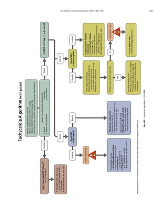 C.D. Deakin et al. / Resuscitation 81 (2010) 1305–1352                                                   1329




                                                         Fig. 4.11. Tachycardia algorithm. © 2010 ERC.
 