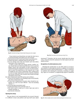 R.W. Koster et al. / Resuscitation 81 (2010) 1277–1292                                                         1281




     Fig. 2.9. Interlock the ﬁngers of your hands. Keep your arms straight.

                                                                                                        Fig. 2.10. Press down on the sternum at least 5 cm.
         If your initial rescue breath does not make the chest rise as
      in normal breathing, then before your next attempt:
    • look into the victim’s mouth and remove any obstruction;                          movement.49 Therefore, the lay rescuer should open the airway
    • recheck that there is adequate head tilt and chin lift;                           using a head-tilt-chin-lift manoeuvre for both injured and non-
    • do not attempt more than two breaths each time before                             injured victims.
      returning to chest compressions.
                                                                                        Recognition of cardiorespiratory arrest
         If there is more than one rescuer present, another res-
      cuer should take over delivering CPR every 2 min to prevent
                                                                                           Checking the carotid pulse (or any other pulse) is an inaccu-
      fatigue. Ensure that interruption of chest compressions is
                                                                                        rate method of conﬁrming the presence or absence of circulation,
      minimal during the changeover of rescuers. For this purpose,
                                                                                        both for lay rescuers and for professionals.50–52 There is, however,
      and to count 30 compressions at the required rate, it may
                                                                                        no evidence that checking for movement, breathing or cough-
      be helpful for the rescuer performing chest compressions
                                                                                        ing (“signs of a circulation”) is diagnostically superior. Healthcare
      to count out loud. Experienced rescuers could do combined
      two-rescuer CPR and in that situation they should exchange
      roles/places every 2 min.
6b. Chest-compression-only CPR may be used as follows:
    • If you are not trained, or are unwilling to give rescue breaths,
      give chest compressions only.
    • If only chest compressions are given, these should be con-
      tinuous, at a rate of at least 100 min−1 (but not exceeding
      120 min−1 ).
 7. Do not interrupt resuscitation until:
    • professional help arrives and takes over; or
    • the victim starts to wake up: to move, open eyes and to
      breathe normally; or
    • you become exhausted.

Opening the airway

    The jaw thrust is not recommended for lay rescuers because
it is difﬁcult to learn and perform and may itself cause spinal                         Fig. 2.11. Blow steadily into his mouth whilst watching for his chest to rise.
 