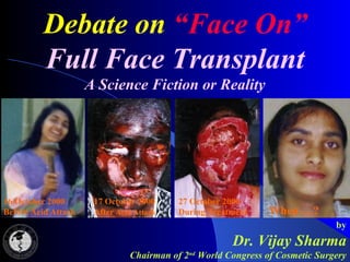 Debate on “Face On”
Full Face Transplant
A Science Fiction or Reality
by
Dr. Vijay Sharma
Chairman of 2nd
World Congress of Cosmetic Surgery
16 October 2000
Before Acid Attack
17 October 2000
After Acid Attack
27 October 2000
During Treatment When …?
 