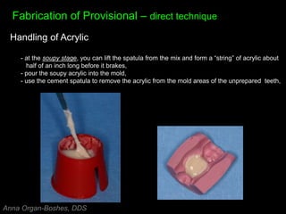 Fabrication of Provisional – direct technique
Handling of Acrylic
- at the soupy stage, you can lift the spatula from the mix and form a “string” of acrylic about
half of an inch long before it brakes,
- pour the soupy acrylic into the mold,
- use the cement spatula to remove the acrylic from the mold areas of the unprepared teeth,
Anna Organ-Boshes, DDS
 