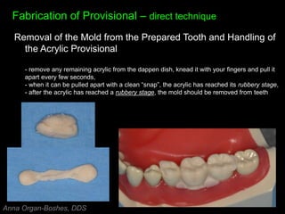Fabrication of Provisional – direct technique
Removal of the Mold from the Prepared Tooth and Handling of
the Acrylic Provisional
- remove any remaining acrylic from the dappen dish, knead it with your fingers and pull it
apart every few seconds,
- when it can be pulled apart with a clean “snap”, the acrylic has reached its rubbery stage,
- after the acrylic has reached a rubbery stage, the mold should be removed from teeth
Anna Organ-Boshes, DDS
 