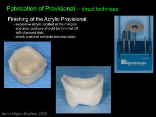 Fabrication of Provisional – direct technique
Finishing of the Acrylic Provisional
- excessive acrylic located at the margins
and axial contours should be trimmed off
with diamond disk,
- check proximal contacts and occlusion,
Anna Organ-Boshes, DDS
 
