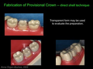 Fabrication of Provisional Crown – direct shell technique
Transparent form may be used
to evaluate the preparation.
Anna Organ-Boshes, DDS
 