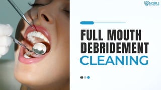 Full Mouth Debridement Cleaning