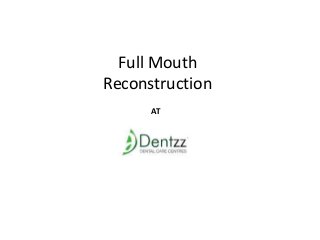 Full Mouth
Reconstruction
AT
 