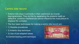 Full mouth rehabilitation in prostho.pptx