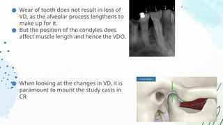 Full Mouth Rehabilitation (Centric Relation).pptx