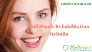 Full Mouth Rehabilitation
In India
dentalimplantsindia.org
 