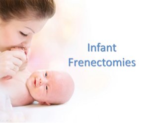 Infant Frenectomies - Laser Frenectomy