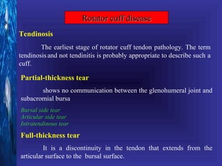 Rotator cuff disease
Tendinosis
        The earliest stage of rotator cuff tendon pathology. The term
tendinosis and not tendinitis is probably appropriate to describe such a
cuff.

Partial-thickness tear
       shows no communication between the glenohumeral joint and
subacromial bursa.
Bursal side tear
Articular side tear
Intratendinous tear
Full-thickness tear
         It is a discontinuity in the tendon that extends from the
articular surface to the bursal surface.
 