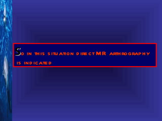 So in th is s itu ation d ire ct M R arth rograp h y
is ind icate d
 