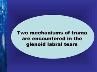 Two mechanisms of truma
 are encountered in the
   glenoid labral tears
 
