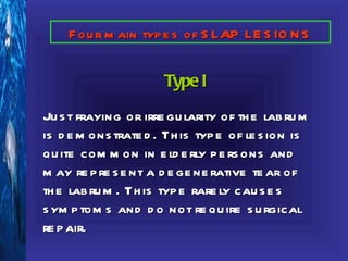 F ou r m ain typ e s of S LAP LE S IO N S


                      Type I
Ju s t fraying or irre gu larity of th e lab ru m
is d e m ons trate d . Th is typ e of le s ion is
qu ite com m on in e ld e rly p e rs ons and
m ay re p re s e nt a d e ge ne rative te ar of
th e lab ru m . Th is typ e rare ly cau s e s
s ym p tom s and d o not re qu ire s u rgical
re p air.
 