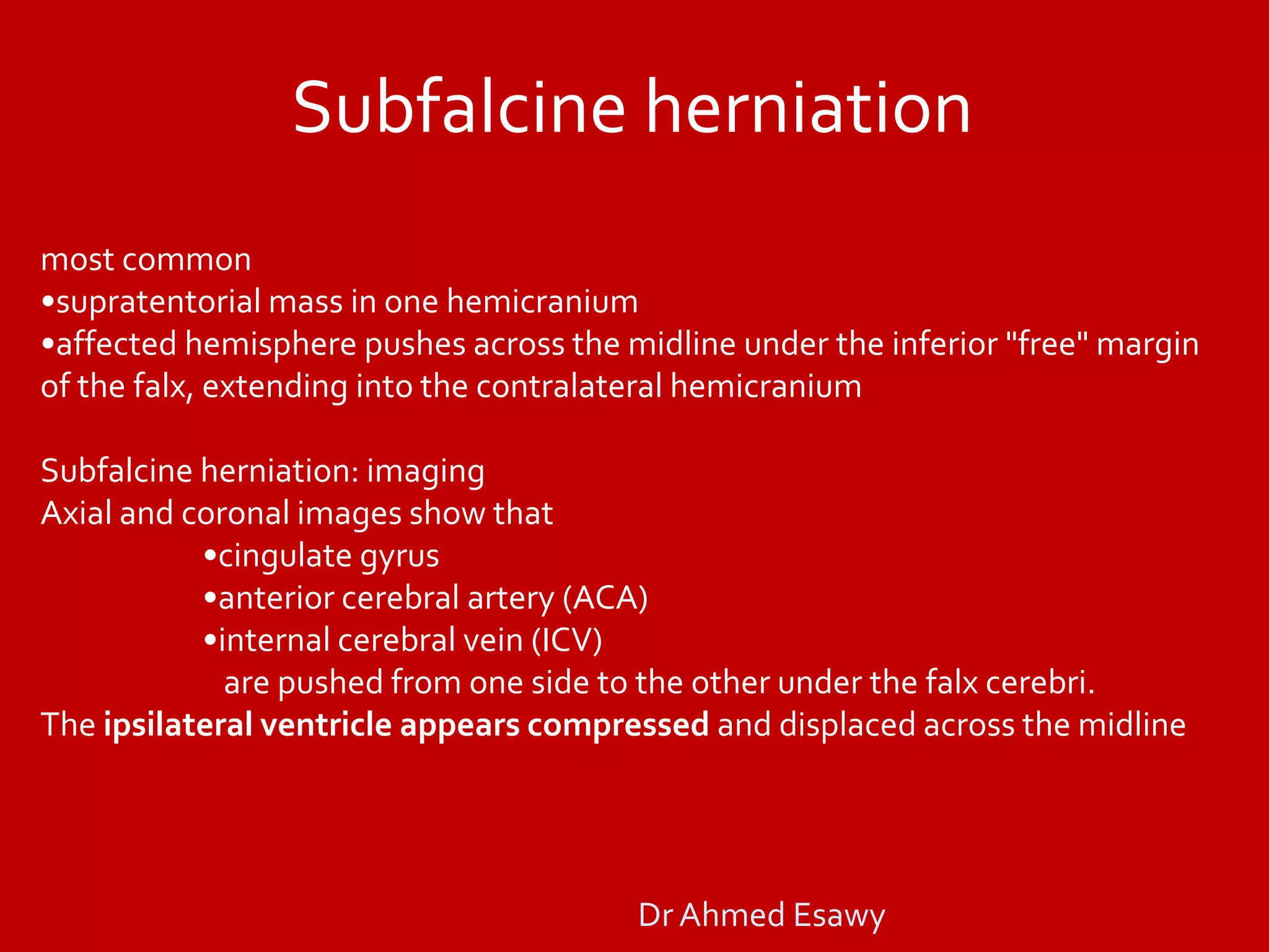 Subfalcine Full story brain herniation imaging Dr Ahmed Esawy | PDF