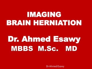 IMAGING
BRAIN HERNIATION
Dr. Ahmed Esawy
MBBS M.Sc. MD
Dr Ahmed Esawy
 