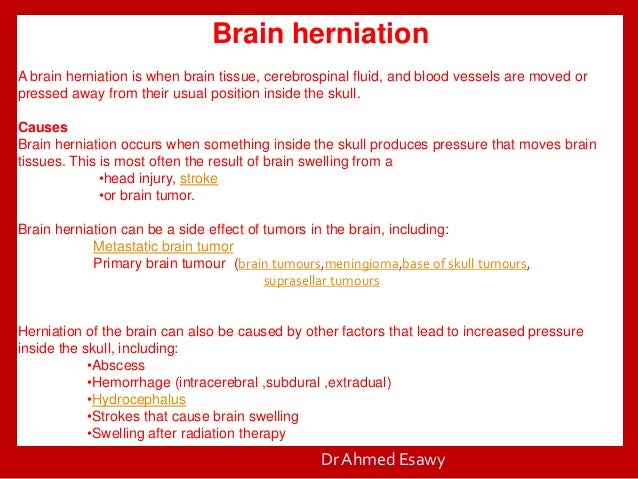 brain herniation