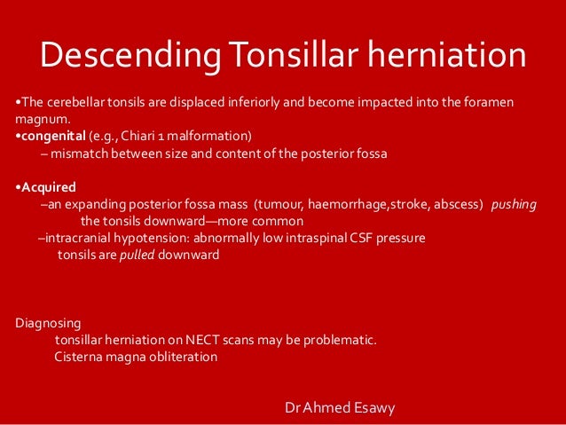 Full story brain herniation imaging Dr Ahmed Esawy