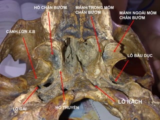 full Thực Hành Giải Phẫu 1.pdf