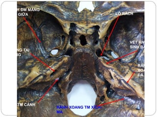 full Thực Hành Giải Phẫu 1.pdf