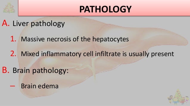PATHOLOGY
A. Liver pathology
1. Massive necrosis of the hepatocytes
2. Mixed inflammatory cell infiltrate is usually prese...