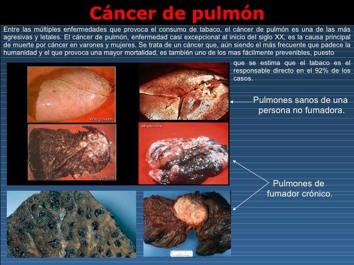 cuanto tiempo debo hacer ejercicio cardiovascular para bajar de peso cuanto tiempo debo hacer ejercicio cardiovascular para bajar de peso