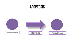 Tejido NormalTejido Normal APOPTOSIS
 