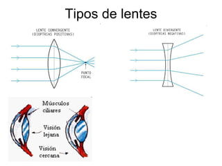 Tipos de lentes 