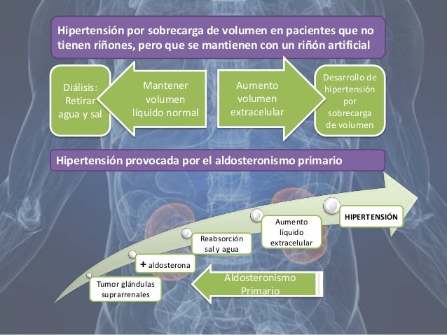 Resultado de imagen para Hipertensión por sobrecarga de volumen en pacientes que no tienen riñones, pero que se mantienen con un riñón artificial