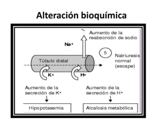 Alteración bioquímica
 