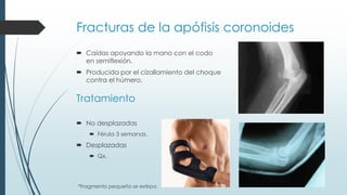 Funcionalidad del codo | PPTX