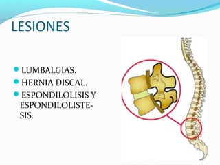 LESIONES

LUMBALGIAS.
HERNIA DISCAL.
ESPONDILOLISIS Y
 ESPONDILOLISTE-
 SIS.
 