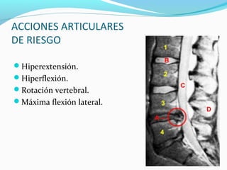 ACCIONES ARTICULARES
DE RIESGO

Hiperextensión.
Hiperflexión.
Rotación vertebral.
Máxima flexión lateral.
 