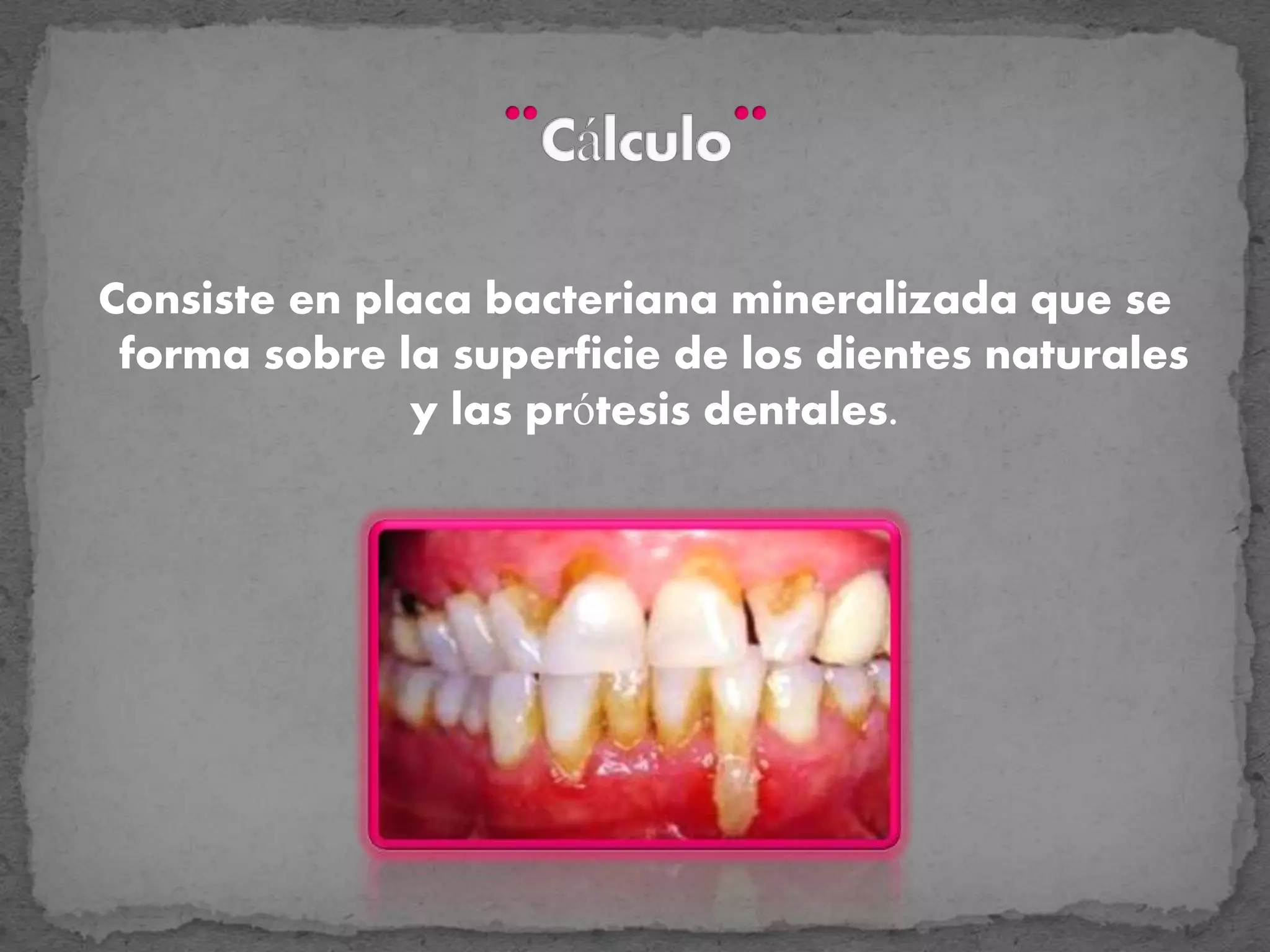 Tema Funcion del Calculo | PDF | Dental Health | Diseases and Conditions