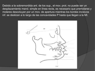 Debido a la sobremordida ant. de los sup., el mov. prot. no puede ser un
desplazamiento mand. simple en línea recta, es necesario que premolares y
molares desocluyan por un mov. de apertura mientras los bordes incisivos
inf. se deslizan a lo largo de las concavidades P hasta que llegan a la MI.
 