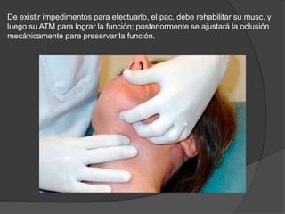 De existir impedimentos para efectuarlo, el pac. debe rehabilitar su musc. y
luego su ATM para lograr la función; posteriormente se ajustará la oclusión
mecánicamente para preservar la función.
 