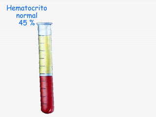 Hematocrito
normal
45 %

 