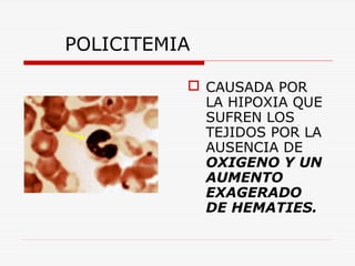 POLICITEMIA
 CAUSADA POR
LA HIPOXIA QUE
SUFREN LOS
TEJIDOS POR LA
AUSENCIA DE
OXIGENO Y UN
AUMENTO
EXAGERADO
DE HEMATIES.

 