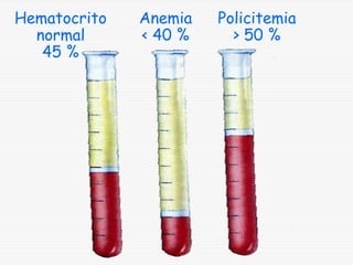 Hematocrito
normal
45 %

Anemia
< 40 %

Policitemia
> 50 %

 