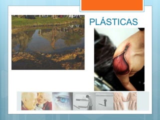 PLÁSTICAS
PLÁSTICAS
 