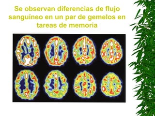 Se observan diferencias de flujo
sanguíneo en un par de gemelos en
tareas de memoria
 