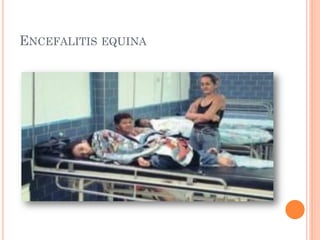 ENCEFALITIS EQUINA
 